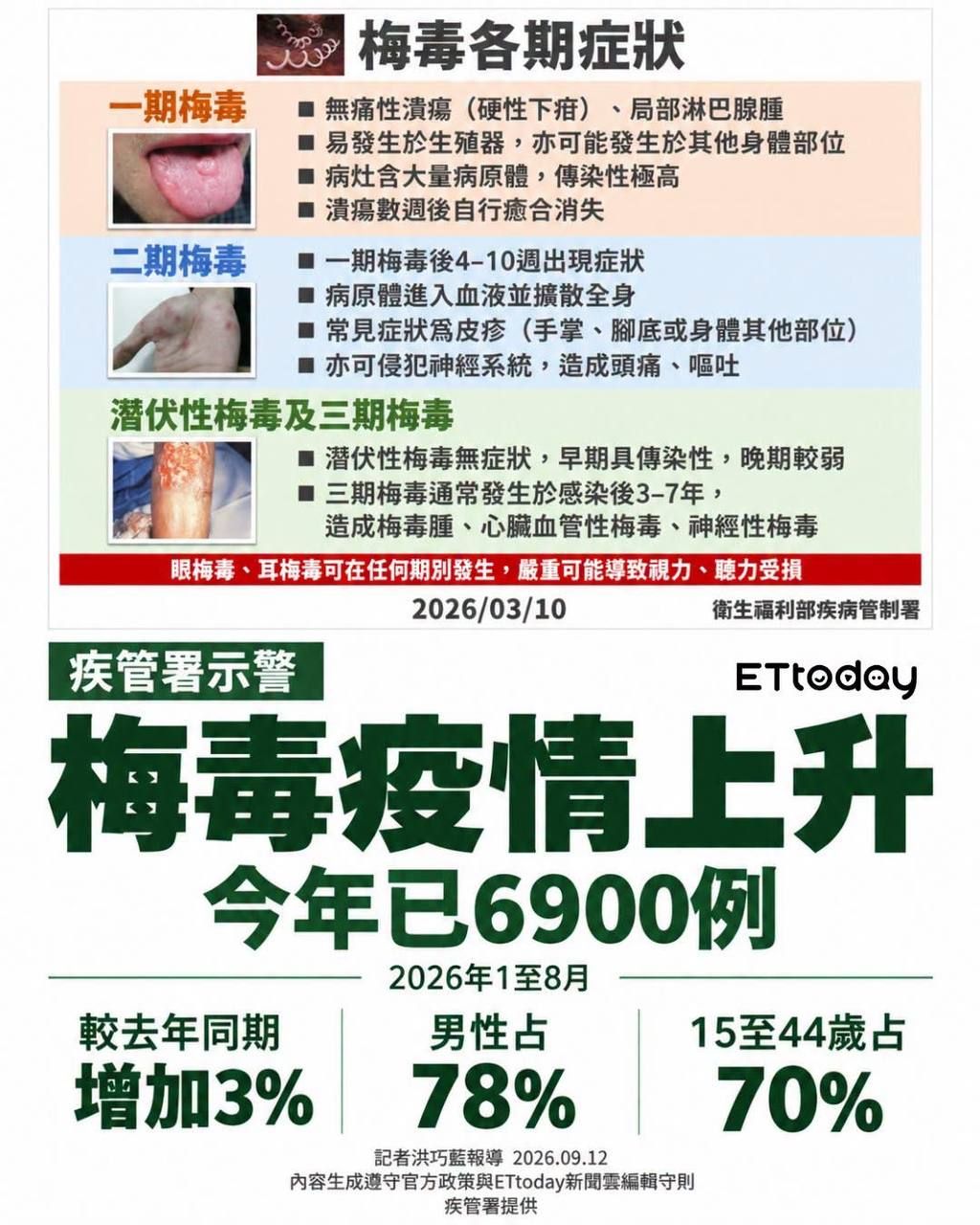 梅毒大爆發